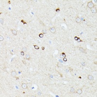 CCDC6 antibody