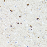 Anti-CCDC6 Antibody