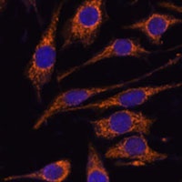 Anti-CCDC6 Antibody