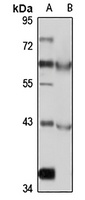 Cyclin I Rabbit Polyclonal Antibody