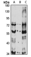 Cyclin L2 Rabbit Polyclonal Antibody