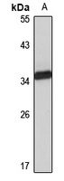 CCS Antibody
