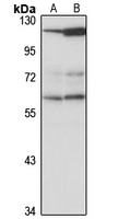CCT6B Antibody