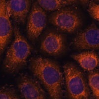 Anti-CCT6B Antibody
