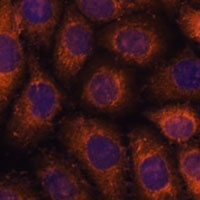 CCT6B antibody