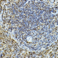 Anti-CD79a Antibody