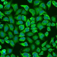 Anti-CD79a Antibody