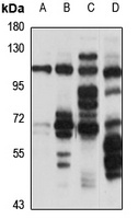 BR Cadherin Rabbit Polyclonal Antibody