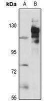 P Cadherin Rabbit Polyclonal Antibody