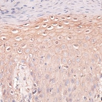Anti-P Cadherin Antibody