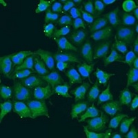 Anti-CDK16 Antibody