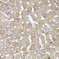 Anti-CDK5RAP1 Antibody