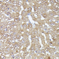 CDK5RAP1 antibody