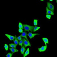 Anti-CDKAL1 Antibody