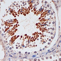 Anti-p16 INK4a Antibody