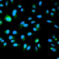 Anti-p16 INK4a Antibody