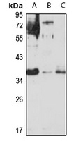 CDX4 Rabbit Polyclonal Antibody