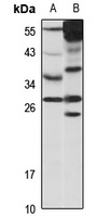 C/EBP delta Rabbit Polyclonal Antibody