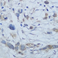 Anti-CEMIP Antibody