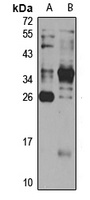 CENPH Rabbit Polyclonal Antibody