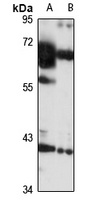 CENPN Rabbit Polyclonal Antibody