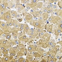 CEP164 antibody