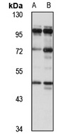 CEP85 Rabbit Polyclonal Antibody