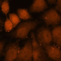 CEP85 Rabbit Polyclonal Antibody