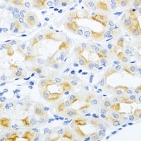 Anti-CGB3 Antibody