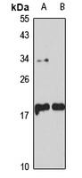 CGGBP1 Rabbit Polyclonal Antibody