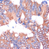 Anti-Cingulin Antibody