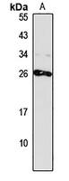 CHCHD6 Rabbit Polyclonal Antibody