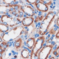 Anti-CHDH Antibody