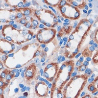 CHDH antibody