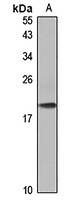 CHIC2 Antibody