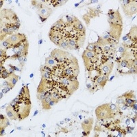 Anti-CHIC2 Antibody