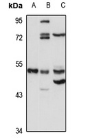Choline Kinase alpha Rabbit Polyclonal Antibody