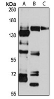 CHL1 Rabbit Polyclonal Antibody