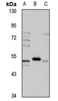 AChR alpha 7 Rabbit Polyclonal Antibody