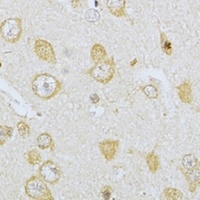 AChR alpha 7 Rabbit Polyclonal Antibody