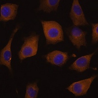 AChR alpha 7 Rabbit Polyclonal Antibody