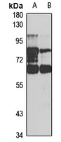 CHRNB1 Rabbit Polyclonal Antibody