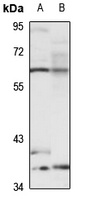 AChR delta Rabbit Polyclonal Antibody