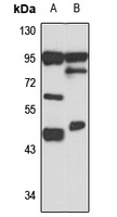 CHST11 Rabbit Polyclonal Antibody