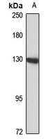 CTF18 Rabbit Polyclonal Antibody