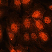 Anti-CTF18 Antibody