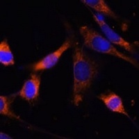 Anti-CKMT1B Antibody