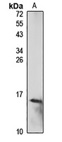 Galectin 10 Rabbit Polyclonal Antibody