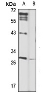 CLEC1B Antibody