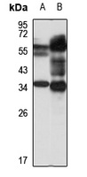 LLT1 Rabbit Polyclonal Antibody